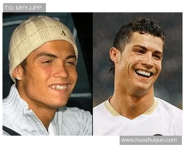 足球明星整牙的原因揭秘提升形象与职业生涯的双重价值 足球明星整牙的原因揭秘提升形象与职业生涯的双重价值